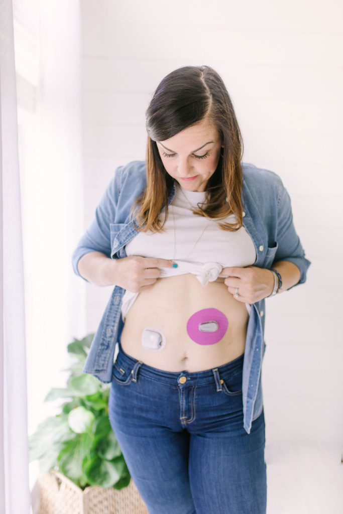 woman with insulin pump and deacon