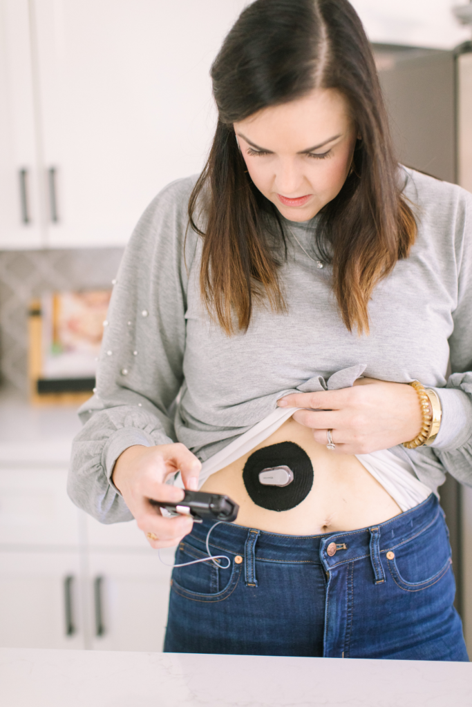 woman with type 1 diabetes dexcom tandem insulin pump